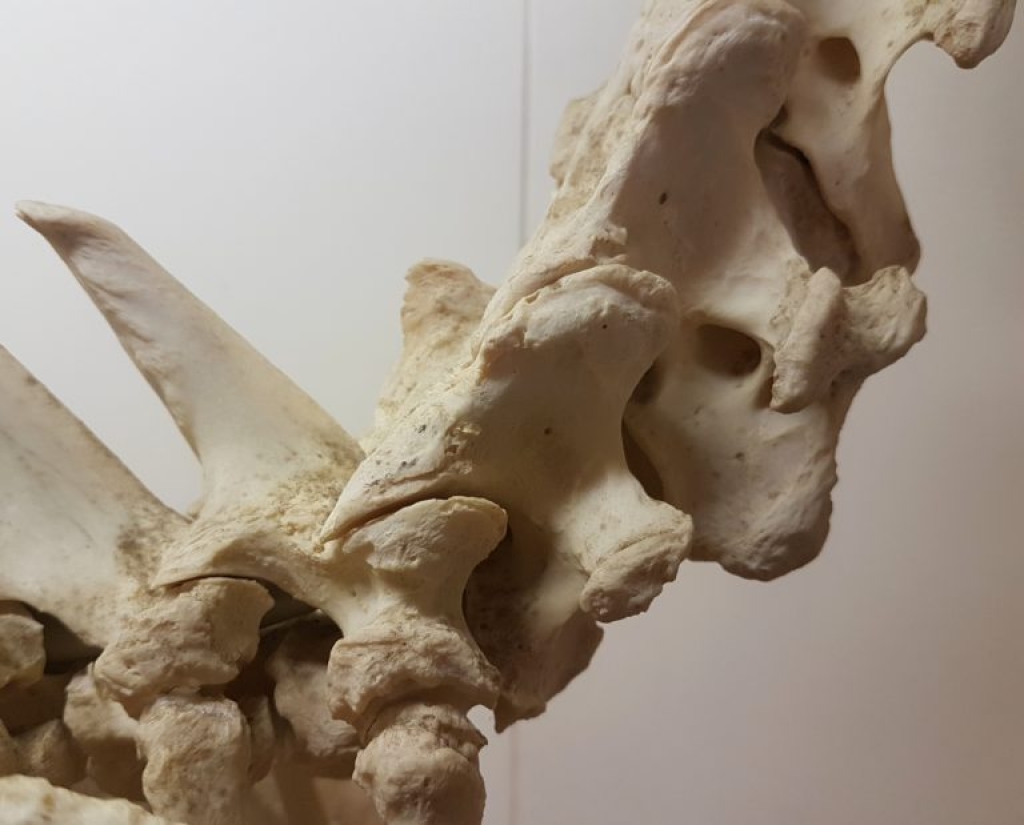 Wervellichamen T1-C6