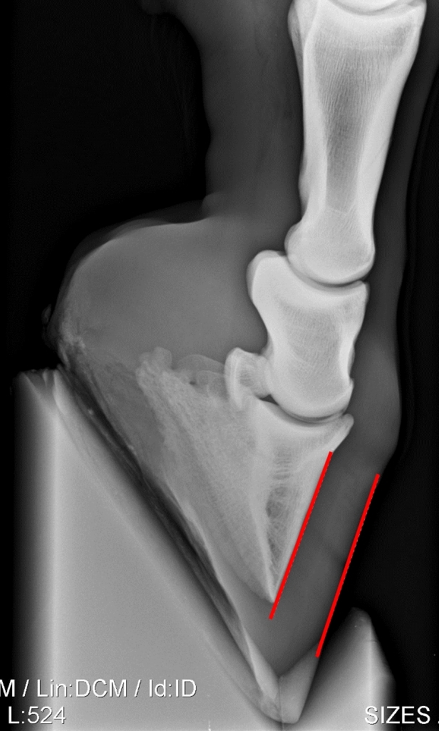 rontgenfoto ondervoet 