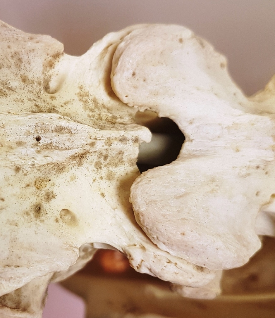 facetgewrichten bovenaanzicht.