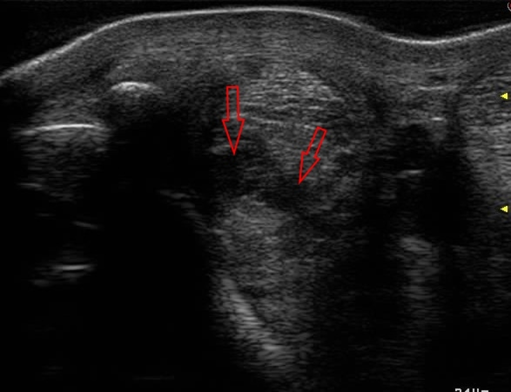Dwarsdoorsnede van een blessure in een tussenpees tak.