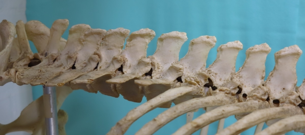 De overgang van borstwervels naar lendenwervels