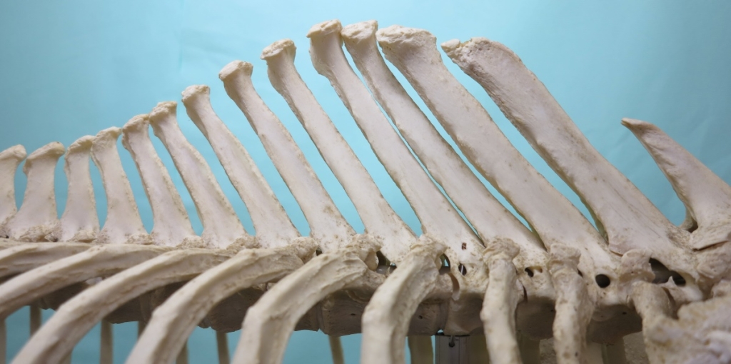 De schoftwervels met de prominente doornuitsteeksels.