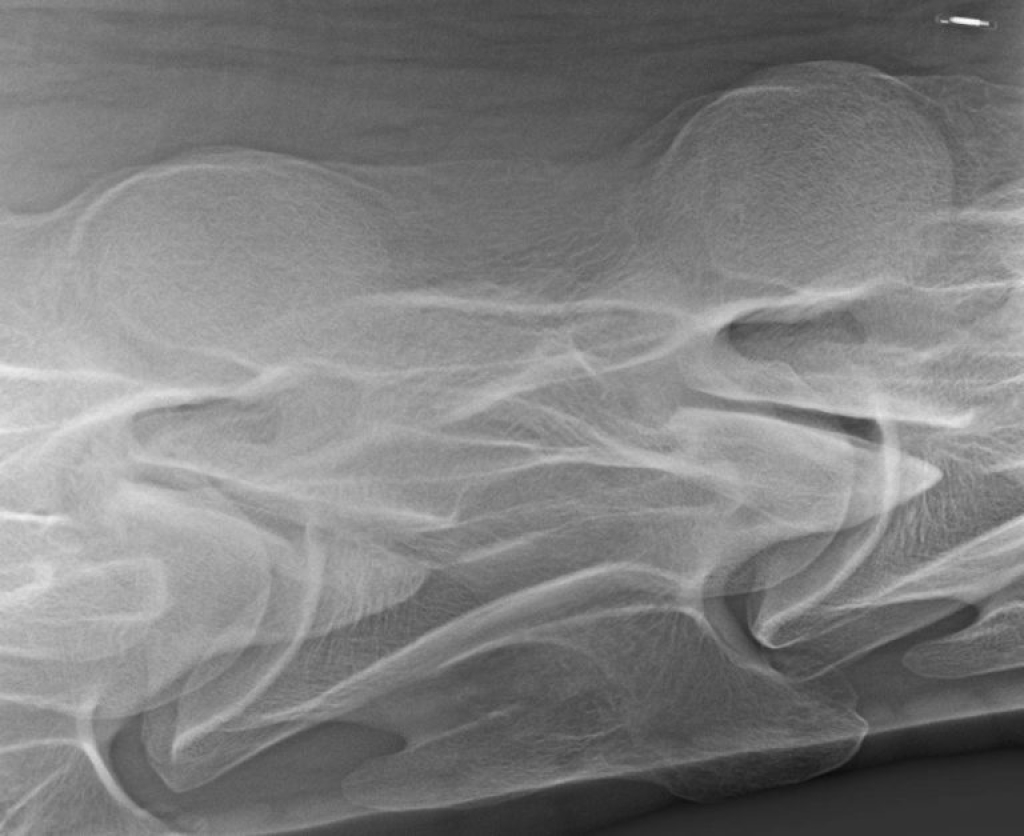 Uitprojectie facetgewricht