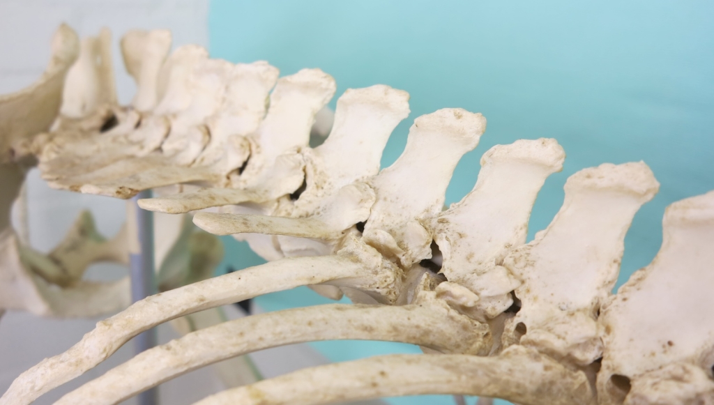 De facetgewrichten van de rug