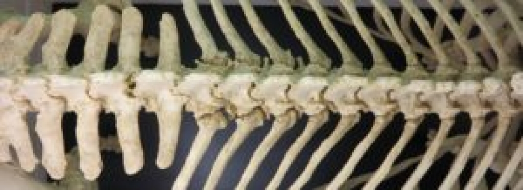 Bovenaanzicht van de wervelkolom met rechts de borstwervels en links het voorste deel van het heiligbeen