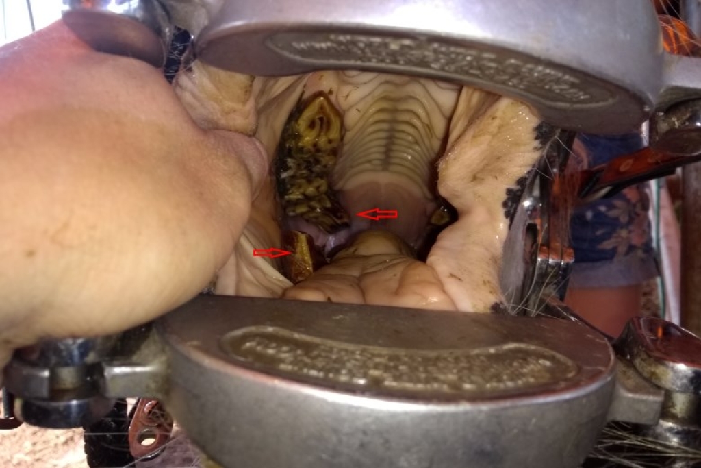 Forse haken op de voorste en achterste kiezen.