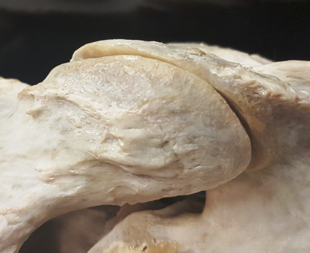 close-up van het facetgewricht