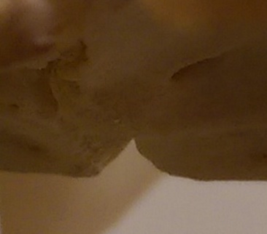 Skelet: Lumbosacrale overgang