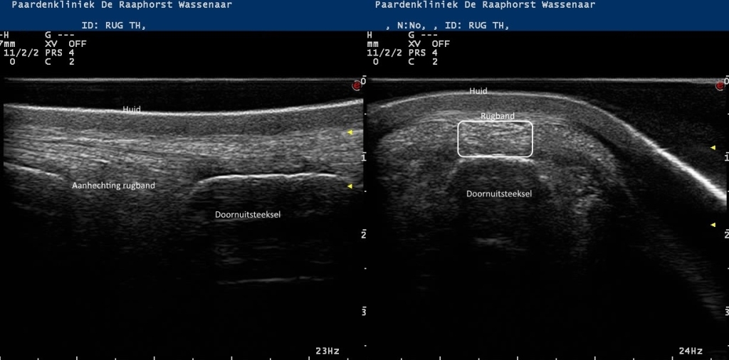 Echobeelden van de lengte en dwarsdoorsnede van de rugband