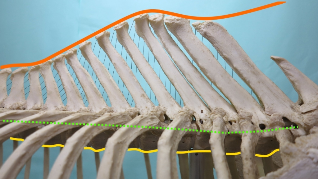 De ligamenten van de rug. De rugband is in het oranje aangegeven met daaronder de interspinaal ligamenten in het zwart